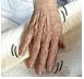 tremoring hand of an elderly person